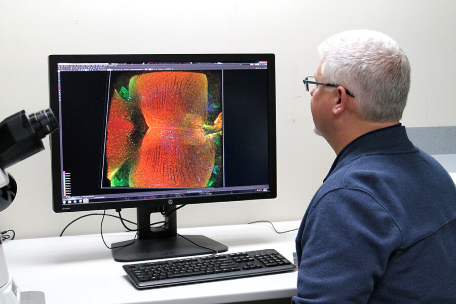 Michael Taylor looking at a microscope image of brain vasculature.
